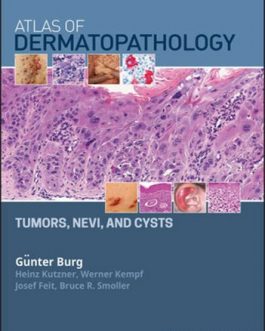 Atlas of Dermatopathology: Tumors, Nevi, and Cysts – eBook