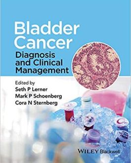 Bladder Cancer: Diagnosis and Clinical Management – eBook PDF