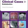 Clinical Cases in Endodontics – eBook PDF