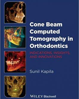 Cone Beam Computed Tomography in Orthodontics – eBook PDF