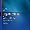 Hepatocellular Carcinoma: Diagnosis and Treatment (3rd Edition) – eBook PDF