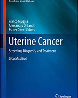 Uterine Cancer: Screening, Diagnosis, and Treatment (2nd Edition) – eBook PDF
