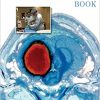 The NeuroICU Book (2nd Edition) – eBook PDF