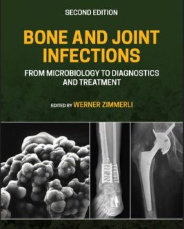 Bone and Joint Infections: From Microbiology to Diagnostics and Treatment (2nd Edition) – eBook PDF