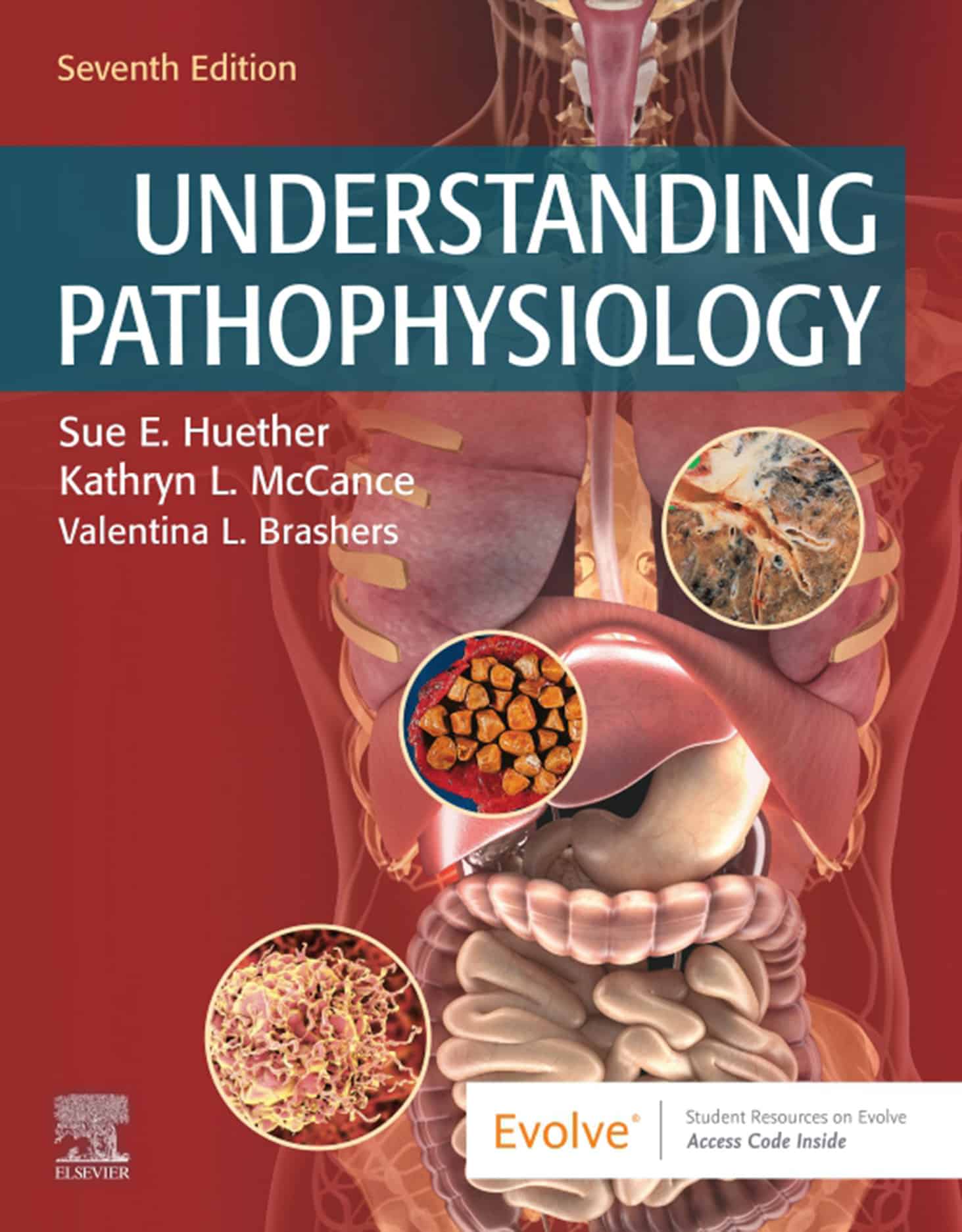 You are currently viewing Understanding Pathophysiology (7th Edition) – eBook PDF